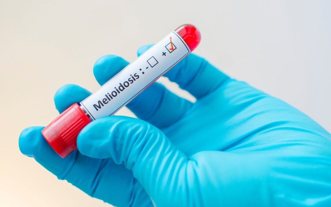 Wet season reminder: Protect yourself against melioidosis